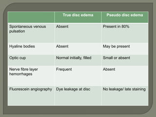 True disc edema Pseudo disc edema
Spontaneous venous
pulsation
Absent Present in 80%
Hyaline bodies Absent May be present
Optic cup Normal initially, filled Small or absent
Nerve fibre layer
hemorrhages
Frequent Absent
Fluorescein angiography Dye leakage at disc No leakage/ late staining
 