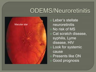  Leber’s stellate
neuroretinitis
 No risk of MS
 Cat scratch disease,
syphilis, Lyme
disease, HIV
 Look for systemic
cause
 Presents like ON
 Good prognosis
Macular star
 