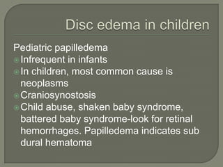 Pediatric papilledema
Infrequent in infants
In children, most common cause is
neoplasms
Craniosynostosis
Child abuse, shaken baby syndrome,
battered baby syndrome-look for retinal
hemorrhages. Papilledema indicates sub
dural hematoma
 