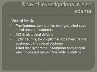 1. Visual fields
• Papilledema, perineuritis: enlarged blind spot,
nasal arcuate scotomas
• AION: altitudinal defects
• Optic neuritis, toxic optic neuropathies: central
scotoma, centrocecal scotoma
• Tilted disc syndrome: bitemporal hemianopia
which does not respect the vertical midline
 