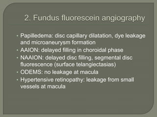 • Papilledema: disc capillary dilatation, dye leakage
and microaneurysm formation
• AAION: delayed filling in choroidal phase
• NAAION: delayed disc filling, segmental disc
fluorescence (surface telangiectasias)
• ODEMS: no leakage at macula
• Hypertensive retinopathy: leakage from small
vessels at macula
 