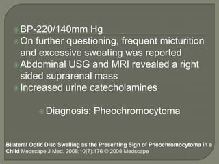 BP-220/140mm Hg
On further questioning, frequent micturition
and excessive sweating was reported
Abdominal USG and MRI revealed a right
sided suprarenal mass
Increased urine catecholamines
Diagnosis: Pheochromocytoma
Bilateral Optic Disc Swelling as the Presenting Sign of Pheochromocytoma in a
Child Medscape J Med. 2008;10(7):176 © 2008 Medscape
 