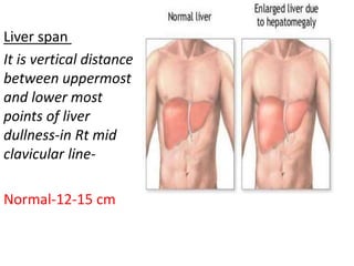 Differential Diagnosis Of Hepatomegaly pptx