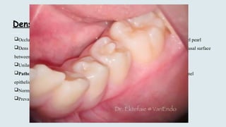 Developmental disturbances of teeth.pptx