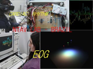 NTAV LAB – BRAZIL
EOG
CARDIAC RHYTHM
 