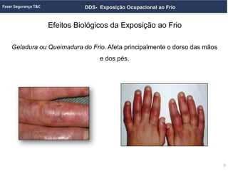 DDS- Exposição Ocupacional ao Frio
Geladura ou Queimadura do Frio. Afeta principalmente o dorso das mãos
e dos pés.
6
Efeitos Biológicos da Exposição ao Frio
6
 