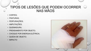 TIPOS DE LESÕES QUE PODEM OCORRER
NAS MÃOS
• CORTES;
• FRATURAS;
• PERFURAÇÕES;
• AMPUTAÇÕES;
• QUEIMADURA;
• PRENSAMENTO POR OBJETO;
• CHOQUE POR ENERGIA ELÉTRICA;
• QUEDA DE OBJETO;
• IMPACTO
 