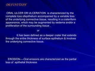 Comprehensive Differential Diagnosis of Oral Ulcers in Clinical ...