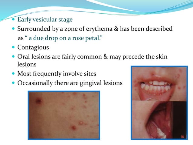 Healed Vesicular Rash DD vesicular lesions.ppt