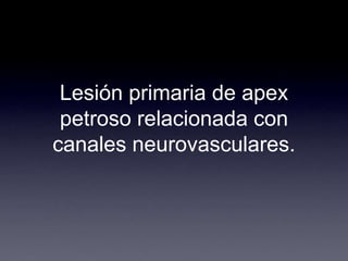 Lesión primaria de apex petroso relacionada con canales neurovasculares.