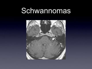 Schwannomas