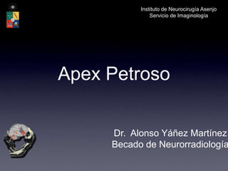 Instituto de Neurocirugía Asenjo Servicio de Imaginología Apex Petroso Dr.  Alonso Yáñez Martínez Becado de Neurorradiología 