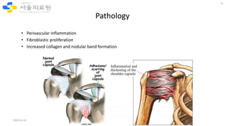 Pathological Shoulder Complex Differential Diagnosis and non-surgical treatment of chronic shoulder ...