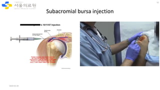 Subacromial Inj Differential Diagnosis and non-surgical treatment of chronic shoulder ...