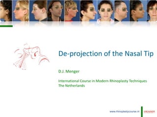 De-projection of the Nasal Tip

D.J. Menger

International Course in Modern Rhinoplasty Techniques
The Netherlands




                              www.rhinoplastycourse.nl
 
