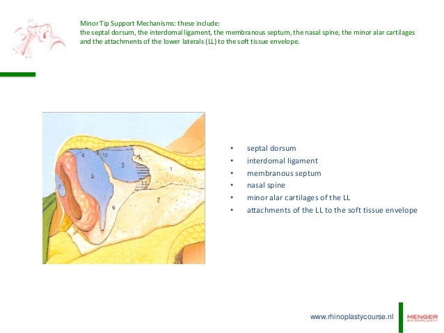 De-projection of the nasal tip