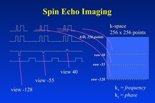 Spin Echo Imaging
view -128
view -55
view 40
                 
                 
                 
k-space
256 x 256 points
row 40
row -55
row -128
A/D, 256 points
kx = frequency
ky = phase
 