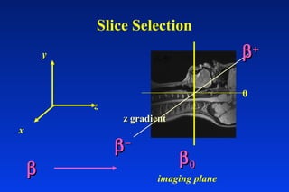 Slice Selection
ββ
z
y
x
0
imaging plane
ββ++
ββ−−
ββ00
z gradientz gradient
 