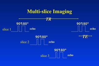 Multi-slice Imaging
echo
90°180°
echo
90°180°
echo
90°180°
echo
90°180°
slice 1
slice 2
slice 3
TRTR
TETE
 