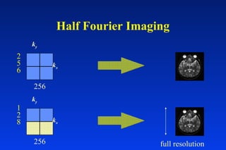 Half Fourier Imaging
kx
ky
256
2
5
6
kx
ky
256
1
2
8
full resolution
 