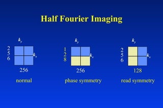 Half Fourier Imaging
kx
ky
256
2
5
6
256
kx
ky
1
2
8
normal phase symmetry
kx
ky
128
2
5
6
read symmetry
 