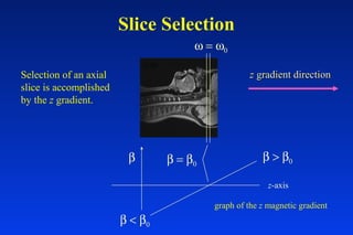 Slice Selection
Selection of an axial
slice is accomplished
by the z gradient.
zz gradient directiongradient direction
ω = ω0
graph of the z magnetic gradient
z-axis
β β = β0
β > β0
β < β0
 
