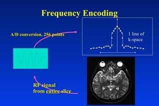 Frequency Encoding
RF signalRF signal
fromfrom entireentire sliceslice
A/D conversion, 256 pointsA/D conversion, 256 points 1 line of
k-space
 