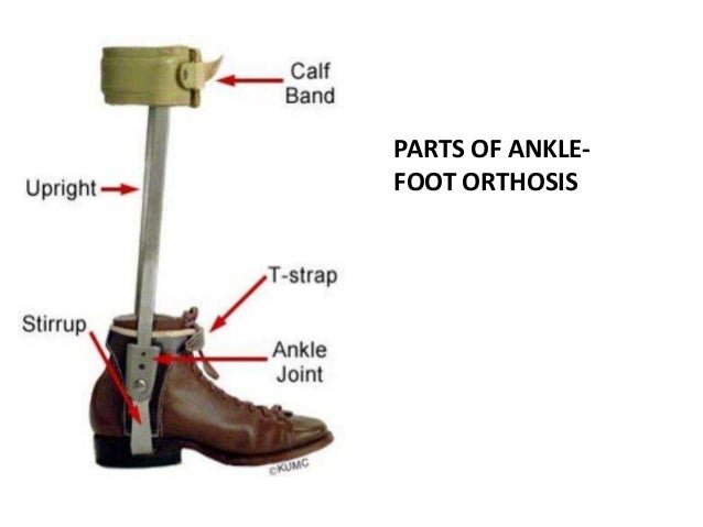 ankle foot orthosis types