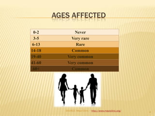 AGES AFFECTED
0-2 Never
3-5 Very rare
6-13 Rare
14-18 Common
19-40 Very common
41-60 Very common
60+ Common
4
SOURCE: Mayo Clinic ~ http://www.mayoclinic.org/
 