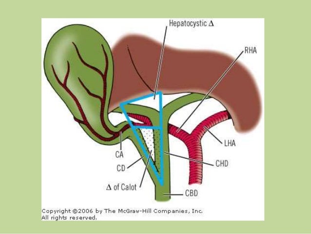 Calot Triangle In Cholecystectomy Diet