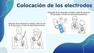 Colocación de los electrodos
 