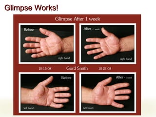 Glimpse Works! 