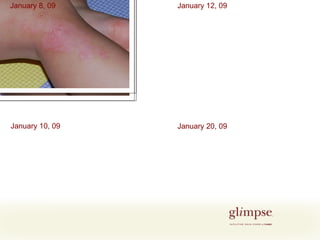 January 8, 09 January 10, 09 January 20, 09 January 12, 09 