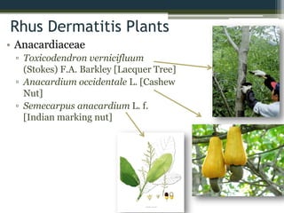 Rhus Dermatitis Plants
• Anacardiaceae
▫ Toxicodendron vernicifluum
(Stokes) F.A. Barkley [Lacquer Tree]
▫ Anacardium occidentale L. [Cashew
Nut]
▫ Semecarpus anacardium L. f.
[Indian marking nut]
 