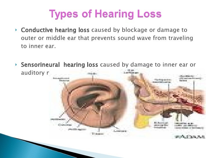 Deaf And Hard Of Hearing