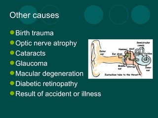 Other causes Birth trauma Optic nerve atrophy  Cataracts Glaucoma Macular degeneration Diabetic retinopathy  Result of accident or illness 