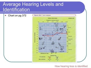 Average Hearing Levels and Identification Chart on pg 372 How hearing loss is identified 