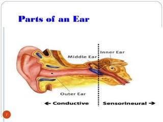 Deaf causes | PPT