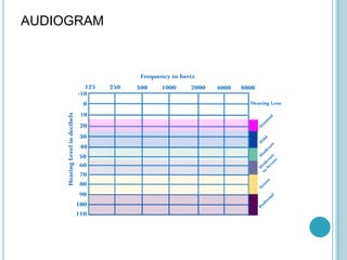 AUDIOGRAM
 