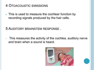 4 OTOACOUSTIC EMISSIONS
This is used to measure the cochlear function by
recording signals produced by the hair cells.
5 AUDITORY BRAINSTEM RESPONSE .
• This measures the activity of the cochlea, auditory nerve
and brain when a sound is heard.
 