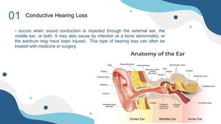 01
- occurs when sound conduction is impeded through the external ear, the
middle ear, or both. It may also cause by infection or a bone abnormality; or
the eardrum may have been injured. This type of hearing loss can often be
treated with medicine or surgery.
Conductive Hearing Loss
 
