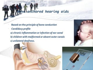 Bone anchored hearing aids
 Based on the principle of bone conduction
 Candidacy profile
a) chronic inflammation or infection of ear canal
b) children with malformed or absent outer canals
c) unilateral deafness.
 