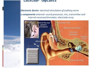 Cochlear implants
Electronic device- electrical stimulation of auditory nerve
2 components external- sound processor, mic, transmitter and
internal-receiver/stimulator, electrode array
 
