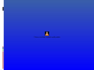 ? How a cochlear implant works.webm
 