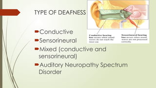 DEAFNESS AND INVESTIGATION, screening, life long disability | PPTX