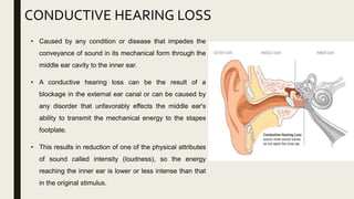 • Caused by any condition or disease that impedes the
conveyance of sound in its mechanical form through the
middle ear cavity to the inner ear.
• A conductive hearing loss can be the result of a
blockage in the external ear canal or can be caused by
any disorder that unfavorably effects the middle ear's
ability to transmit the mechanical energy to the stapes
footplate.
• This results in reduction of one of the physical attributes
of sound called intensity (loudness), so the energy
reaching the inner ear is lower or less intense than that
in the original stimulus.
CONDUCTIVE HEARING LOSS
 