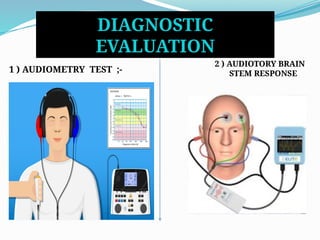 DIAGNOSTIC
EVALUATION
1 ) AUDIOMETRY TEST ;-
2 ) AUDIOTORY BRAIN
STEM RESPONSE
 