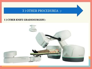 3 ) OTHER PROCEDUREA ;-
1 ) CYBER KNIFE GRADIOSURGERY;-
 