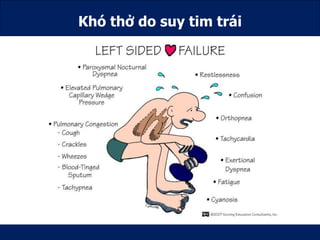 Trieu chung co nang tm | PDF