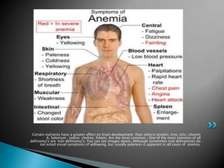 Certain nutrients have a greater affect on brain development than others( protein, iron, zinc, vitamin
          A, Selenium , iodine choline, folate). Are the most common . One of the most common of all
deficiency's are Iron deficiency's. You can see images above, Although sometimes iron deficiencies do
      not entail visual symptoms of yellowing, bur usually paleness is apparent in all cases of anemia.
 
